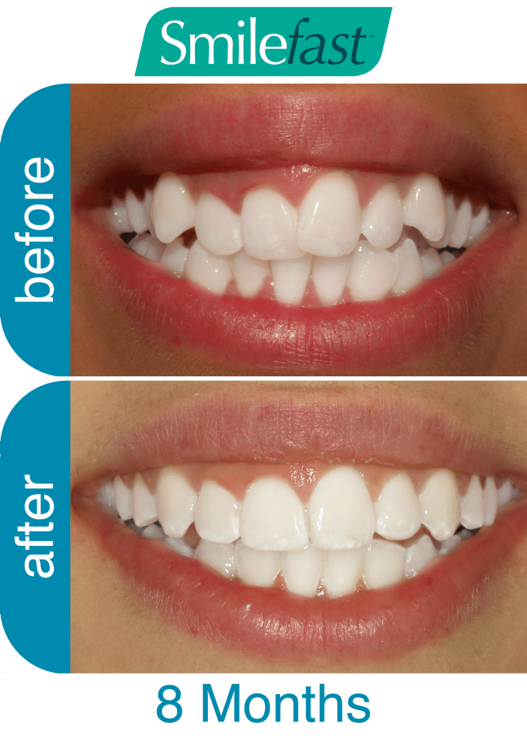 Dental Q & A Adelaide Smile and Implant Centre