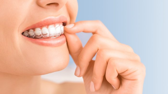 Beautiful smile and white teeth of a young woman.